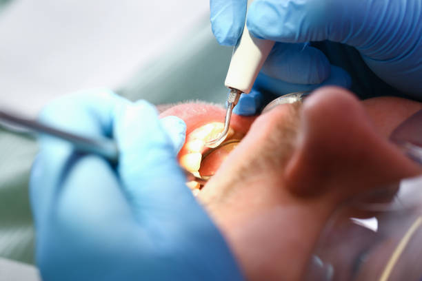 Best Weekend Emergency Dentist in Kingsford, MI